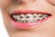 The Effect of Different Output Powers of Blue Diode Laser along with Curcumin and Riboflavin against Streptococcus mutans around Orthodontic Brackets: An In Vitro Study