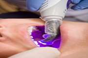 Effect of surface treatment with laser on repair bond strength of composite resin to ceramic 