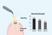 The Effect of Two Different Wavelengths of Diode Laser on the Shear Bond Strength of Composite to Dental Enamel after Bleaching Process: An In Vitro Study