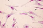 Comparative Evaluation of the Effects of Antimicrobial Photodynamic Therapy With an LED and a Laser on the Proliferation of Human Gingival Fibroblasts on the Root Surface: An In Vitro Study
