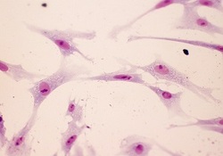 Comparative Evaluation of the Effects of Antimicrobial Photodynamic Therapy With an LED and a Laser on the Proliferation of Human Gingival Fibroblasts on the Root Surface: An In Vitro Study
